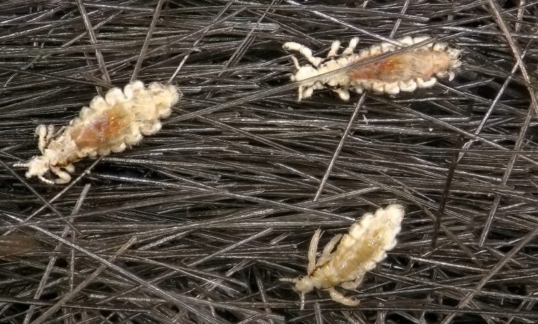 Түсінде биттеп кетсе