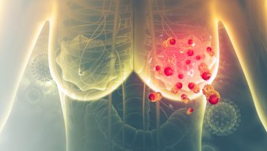 емшектегі түйінді қалай кетіруге болады