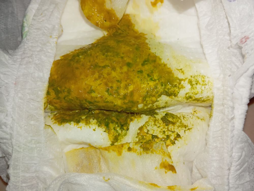 Аяқ фетишіне қатысты фотосуреттер